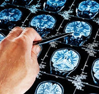 pouvoirs du cerveau